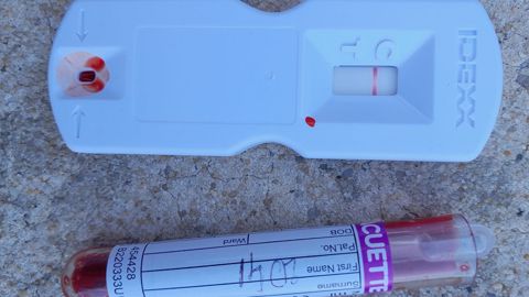 Effectuer un test de gestation demande de réaliser une prise de sang sur ses bovins. (©SCEA Dumontroty) Effectuer un test de gestation demande de réaliser une prise de sang sur ses bovins. (©SCEA Dumontroty)