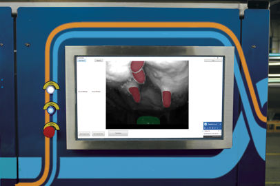 Gemini UP vision system