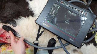 L’échographie a permis de confirmer l’infection du nombril, puis de visualiser l'abcès dans le foie juste après la première intervention. L’échographie a permis de confirmer l’infection du nombril, puis de visualiser l'abcès dans le foie juste après la première intervention.